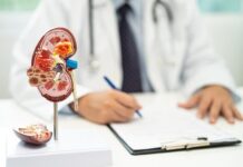 In What Ways Does Diet Affect The Formation Of Kidney Stones? Kidney Stones