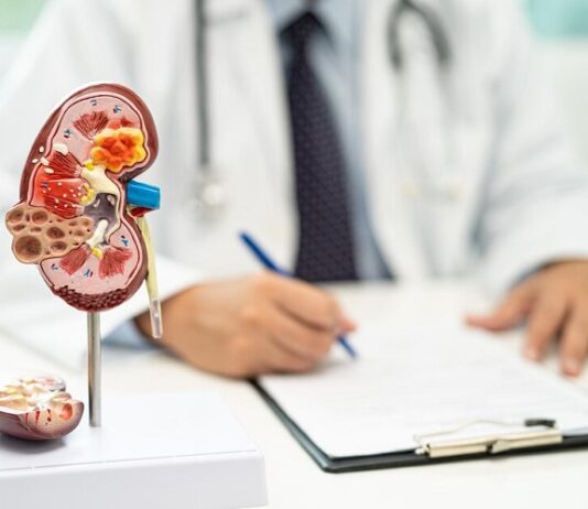 In What Ways Does Diet Affect The Formation Of Kidney Stones? Kidney Stones