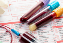 The Importance of Regular Blood Work by NovaHealth Urgent Care NovaHealth