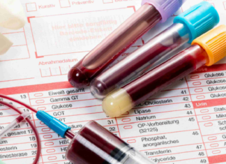 The Importance of Regular Blood Work by NovaHealth Urgent Care NovaHealth